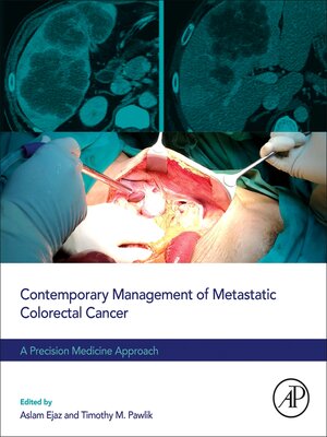 cover image of Contemporary Management of Metastatic Colorectal Cancer